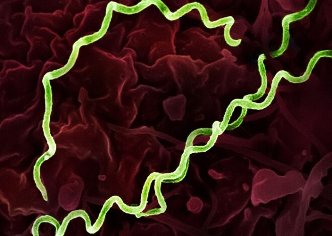 Syphilis Spikes to Levels Unseen Since 1950 in the U.S.