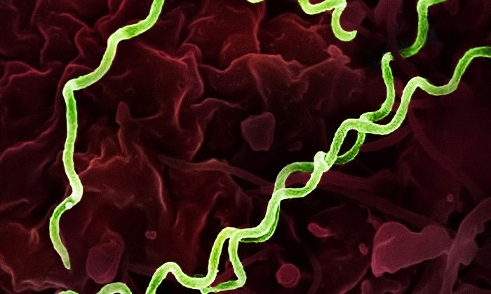 Syphilis Spikes to Levels Unseen Since 1950 in the U.S.